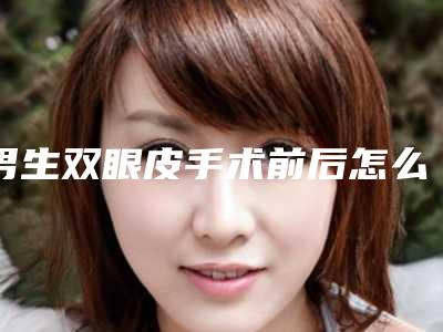 男生双眼皮手术前后怎么护理男生割双眼皮后悔